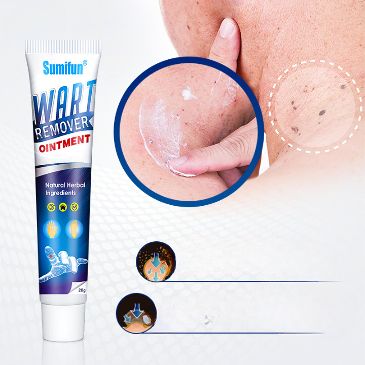 Wabra™ - Crema per verruche profondamente efficace