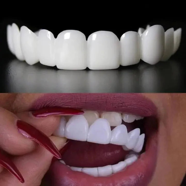 Faccette dentali artificiali