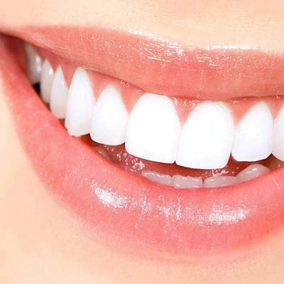 Faccette dentali artificiali