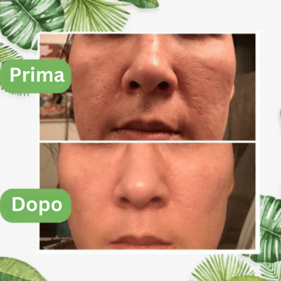 GreenStick™ - Maschera per la pulizia profonda dei pori