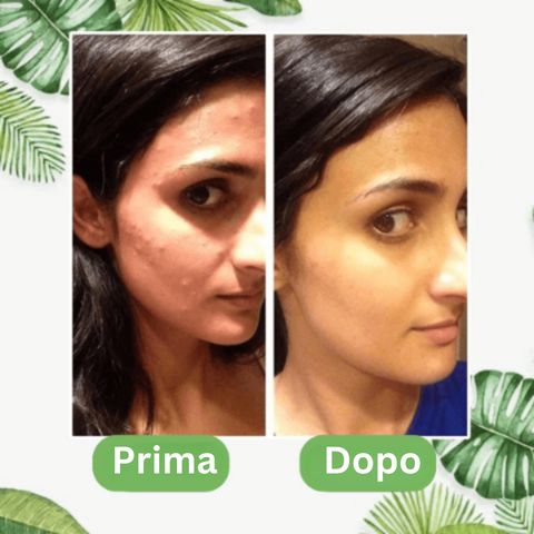 GreenStick™ - Maschera per la pulizia profonda dei pori TT