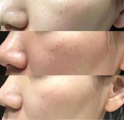 Siero viso anti-età alla curcuma - Siero per la pulizia profonda della pelle