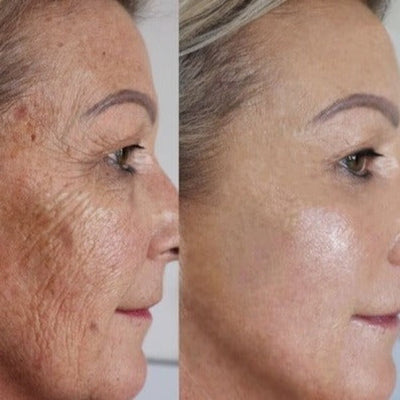 Siero viso anti-età alla curcuma - Siero per la pulizia profonda della pelle